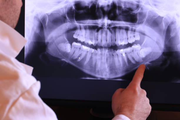 Best Cosmetic Emergency Dentistry in Ligh, NE